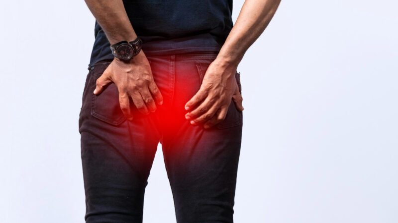 Hemorroidas: sintomas, tratamentos e quando procurar o proctologista